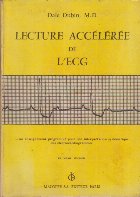 Lecture Acceleree de L ECG