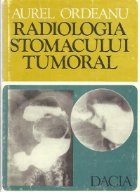 Radiologia stomacului tumoral